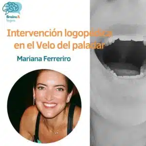 Velo del paladar